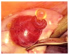 11. OvulationPic