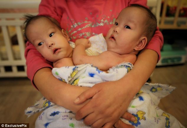 2. The baby girls are joined by the abdomen and specialists will carry out tests to determine if they are share any vital organs - article-2520391-19F3C2AB00000578-416_634x437